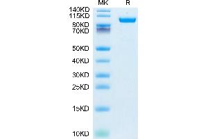 HGFA Protein (AA 36-655) (His tag)