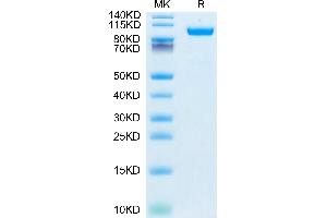 Human HGFA (pro form) on Tris-Bis PAGE under reduced condition. (HGFA Protein (AA 36-655) (His tag))