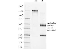 SDS-PAGE Analysis of Purified TIMP1 Mouse Monoclonal Antibody (2A5). (TIMP1 antibody  (AA 72-82))