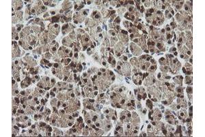 Image no. 1 for anti-Cytidine Monophosphate (UMP-CMP) Kinase 1, Cytosolic (CMPK1) antibody (ABIN1497544) (Cytidine Monophosphate (UMP-CMP) Kinase 1, Cytosolic (CMPK1) antibody)