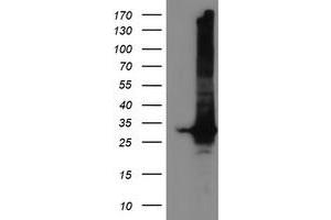 Western Blotting (WB) image for anti-Glutathione S-Transferase theta 2 (GSTT2) antibody (ABIN1498553) (GSTT2 antibody)