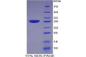 SDS-PAGE of Protein Standard from the Kit (Highly purified E. (NNMT ELISA Kit)