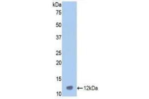 Western blot analysis of the recombinant protein. (Vitronectin antibody  (AA 400-468))