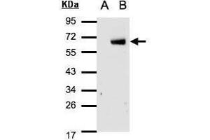WB Image Western Blot analysis of IRF6 expression in transfected 293T cell line by IRF6 polyclonal antibody. (IRF6 antibody  (C-Term))