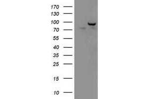 HEK293T cells were transfected with the pCMV6-ENTRY control (Left lane) or pCMV6-ENTRY PDE10A (Right lane) cDNA for 48 hrs and lysed. (PDE10A antibody)