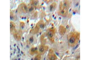 Used in DAB staining on fromalin fixed paraffin-embedded Liver tissue (Caspase 8 antibody  (AA 217-384))