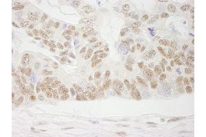 Immunohistochemistry (IHC) image for anti-Cofactor of BRCA1 (COBRA1) (AA 530-580) antibody (ABIN7448942) (COBRA1 antibody  (AA 530-580))