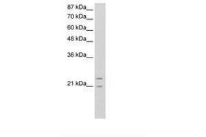Image no. 3 for anti-Polyamine Modulated Factor 1 (PMF1) (AA 41-90) antibody (ABIN6736317) (PMF1 antibody  (AA 41-90))