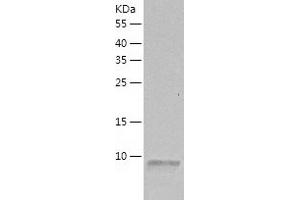 Western Blotting (WB) image for Stromal Cell Derived Factor 1 beta (SDF1b) (AA 22-93) protein (His tag) (ABIN7286081) (SDF1 beta Protein (AA 22-93) (His tag))