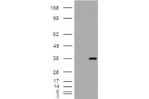 Immunohistochemistry (IHC) image for anti-Monoglyceride Lipase (MGLL) (Internal Region) antibody (ABIN2465954) (MGLL antibody  (Internal Region))