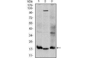 Western blot analysis using UBE2I mouse mAb against Hela (1), HepG2 (2), and Cos7 (3) cell lysate. (UBE2I antibody)