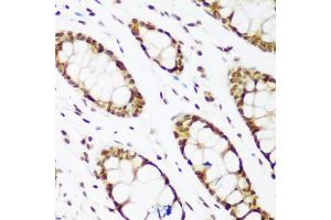 Immunohistochemistry of paraffin-embedded human colon using PCNA antibody (ABIN1874056) at dilution of 1:200 (40x lens). (PCNA antibody)