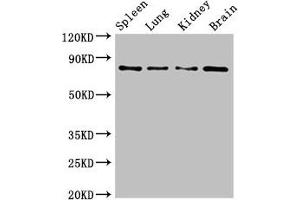 Western Blot Positive WB detected in: Mouse spleen tissue, Mouse lung tissue, Mouse kidney tissue, Mouse brain tissue All lanes: PRMT7 antibody at 6. (PRMT7 antibody  (AA 285-390))