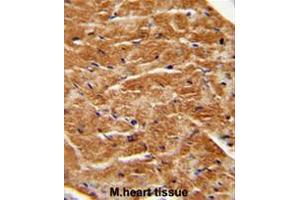 FGF7 antibody (Center) immunohistochemistry analysis in formalin fixed and paraffin embedded human M. (FGF7 antibody  (Middle Region))