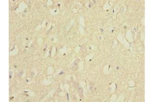 Immunohistochemistry of paraffin-embedded human brain tissue using ABIN7151859 at dilution of 1:100