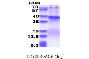 SDS-PAGE (SDS) image for Fucosyltransferase 7 (Alpha (1,3) Fucosyltransferase) (FUT7) (AA 37-342) protein (His tag) (ABIN5777832) (FUT7 Protein (AA 37-342) (His tag))