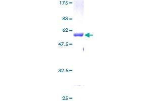 IGFBP6 Protein (AA 1-240) (GST tag)
