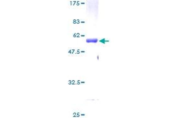 IGFBP6 Protein (AA 1-240) (GST tag)