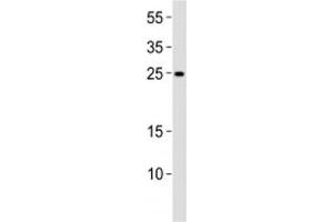 Western blot analysis of lysate from K562 cell line using RAB27A antibody diluted at 1:1000. (RAB27A antibody  (AA 136-164))