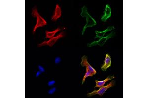 ABIN6265362 and ABIN6272951 staining Hela cells by IF/ICC.