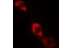 Immunofluorescence (fixed cells) (IF/ICC) image for anti-Inhibitor of kappa Light Polypeptide Gene Enhancer in B-Cells, Kinase gamma (IKBKG) (pSer85) antibody (ABIN6255538)