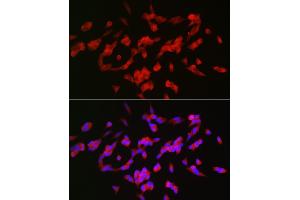 Immunofluorescence analysis of SH-SY5Y cells using G Rabbit pAb (ABIN6127469, ABIN6140954, ABIN6140955 and ABIN6221997) at dilution of 1:25 (40x lens).