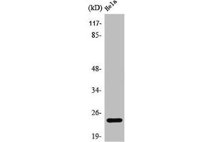 Western Blot analysis of COLO205 cells using PPP1R14D Polyclonal Antibody (PPP1R14D antibody  (Internal Region))