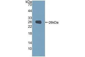 Detection of Recombinant PGM1, Human using Polyclonal Antibody to Phosphoglucomutase 1 (PGM1) (Phosphoglucomutase 1 antibody  (AA 1-235))