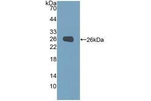 Detection of Recombinant PGM1, Human using Polyclonal Antibody to Phosphoglucomutase 1 (PGM1)