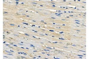 ABIN6263472 and ABIN6278296 at 1/100 staining Rat heart tissue by IHC-P.