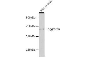 Western blot analysis of extracts of mouse brain, using Aggrecan antibody  at 1:1000 dilution.