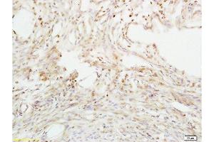 Formalin-fixed and paraffin embedded mouse uterus tissue labeled with Anti-ABP/SHBG Polyclonal Antibody, Unconjugated  at 1:200 followed by conjugation to the secondary antibody and DAB staining