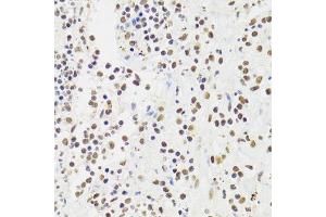 Immunohistochemistry (Paraffin-embedded Sections) (IHC (p)) image for anti-X-Ray Repair Complementing Defective Repair in Chinese Hamster Cells 6 (XRCC6) (AA 500-600) antibody (ABIN1513143)