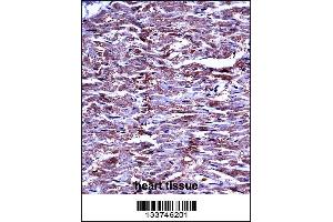 MMP15 Antibody immunohistochemistry analysis in formalin fixed and paraffin embedded human heart tissue followed by peroxidase conjugation of the secondary antibody and DAB staining. (MMP15 antibody  (N-Term))