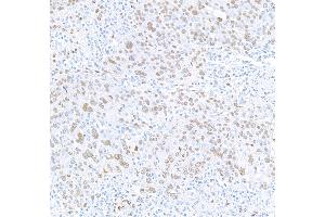 Immunohistochemistry (IHC) image for anti-RNA Binding Motif Protein 9 (RBM9) (AA 1-50) antibody (ABIN7454009) (Recombinant RBM9 antibody  (AA 1-50))