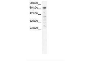 Image no. 2 for anti-Poly (ADP-Ribose) Polymerase Family, Member 3 (PARP3) (AA 446-495) antibody (ABIN6735808) (PARP3 antibody  (AA 446-495))