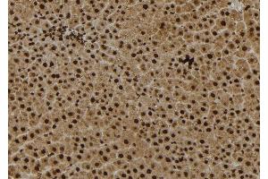 ABIN6279036 at 1/100 staining Rat liver tissue by IHC-P. (RPS27 antibody  (Internal Region))