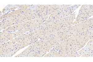 Detection of FOXO3 in Human Cardiac Muscle Tissue using Polyclonal Antibody to Forkhead Box Protein O3 (FOXO3) (FOXO3 antibody  (AA 369-633))