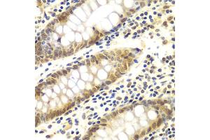 Immunohistochemistry of paraffin-embedded human colon using GNB2L1 antibody (ABIN6292957) at dilution of 1:100 (40x lens). (GNB2L1 antibody)