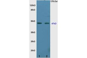 L1 rat brain lysates L2 rat kidney lysates probed with Anti Vitamin D Receptor/VDR Polyclonal Antibody, Unconjugated (ABIN682513) at 1:200 overnight at 4 °C. (Vitamin D Receptor antibody  (AA 65-180))