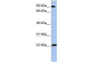 WB Suggested Anti-TMED10 Antibody Titration: 0. (TMED10 antibody  (Middle Region))