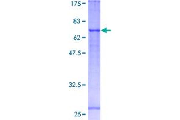 FADS1 Protein (AA 1-444) (GST tag)
