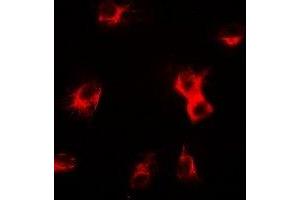 Immunofluorescent analysis of delta-Sarcoglycan staining in U2OS cells. (SGCD antibody)