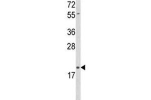 Western blot analysis of DLK2 antibody and HL-60 lysate. (DLK2 antibody  (AA 353-380))