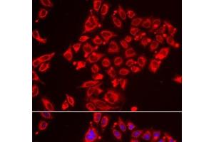 Immunofluorescence analysis of HeLa cells using ST3GAL3 Polyclonal Antibody (ST3GAL3 antibody)