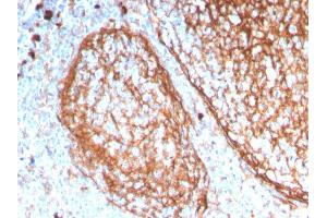 Formalin-fixed, paraffin-embedded human tonsil stained with CD11b Monospecific Mouse Monoclonal Antibody (ITGAM/3338). (CD11b antibody  (AA 941-1074))
