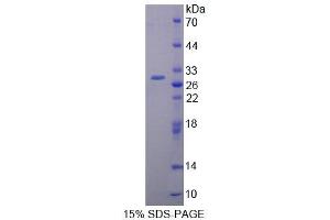 SDS-PAGE analysis of Rat PCM1 Protein. (PCM1 Protein)