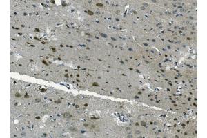 IHC analysis of PCBP2/hnRNP E2 using anti-PCBP2/hnRNP E2 antibody (ABIN7600449). (PCBP2 antibody  (AA 197-276))