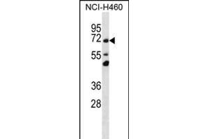 T Antibody (N-term) (ABIN656337 and ABIN2845637) western blot analysis in NCI- cell line lysates (35 μg/lane). (TMEM181 antibody  (N-Term))