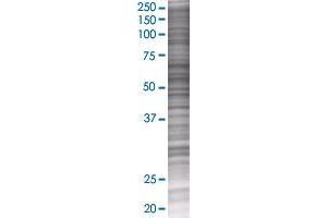PSD3 transfected lysate. (PSD3 293T Cell Transient Overexpression Lysate(Denatured))